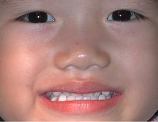 After...