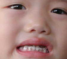 Before: look at the stains!