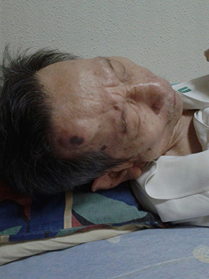 16 Aug: Fell from bed, sent to A&E, TTSH.
